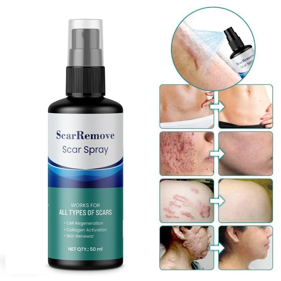Scar Removal Spray 50ml	Pack Of 2 - Premium  from Roposo Clout - Just $600! Shop now at Mystical9