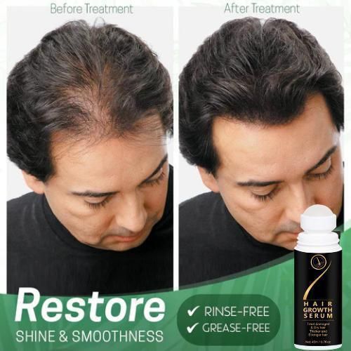 Hair Serum for Hair Growth - Premium  from Roposo Clout - Just $500! Shop now at Mystical9